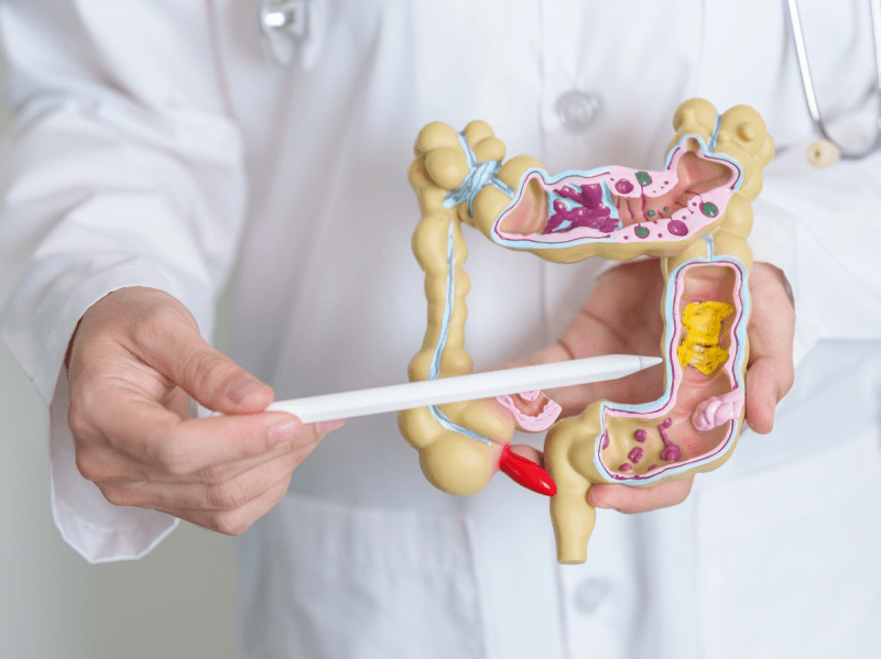 What is Colorectal Cancer? An&nbsp;Overview